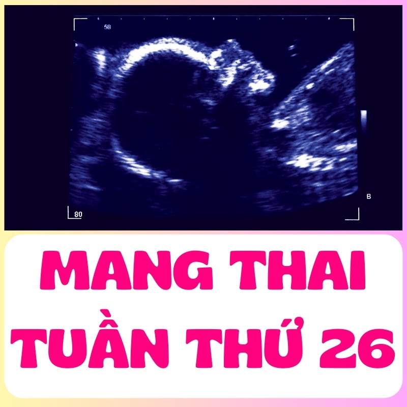 Thai nhi tuần thứ 26 qua siêu âm